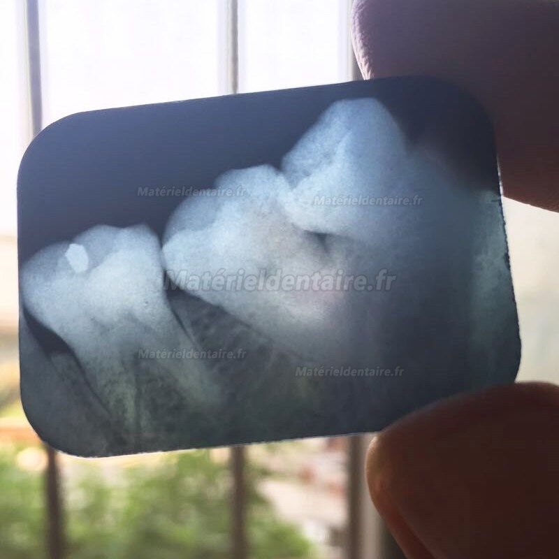 Appareil Radiographique dentaire Portable BLX-10